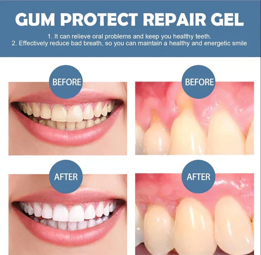 📢📢50% Off!!⏰ Teeth Whitening & Repair Gel 🦷