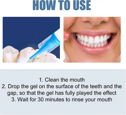📢📢50% Off!!⏰ Teeth Whitening & Repair Gel 🦷