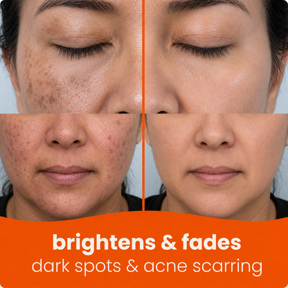 🔥Last Day 68% OFF-Bloomhar Turmeric Kojic Glow Pads