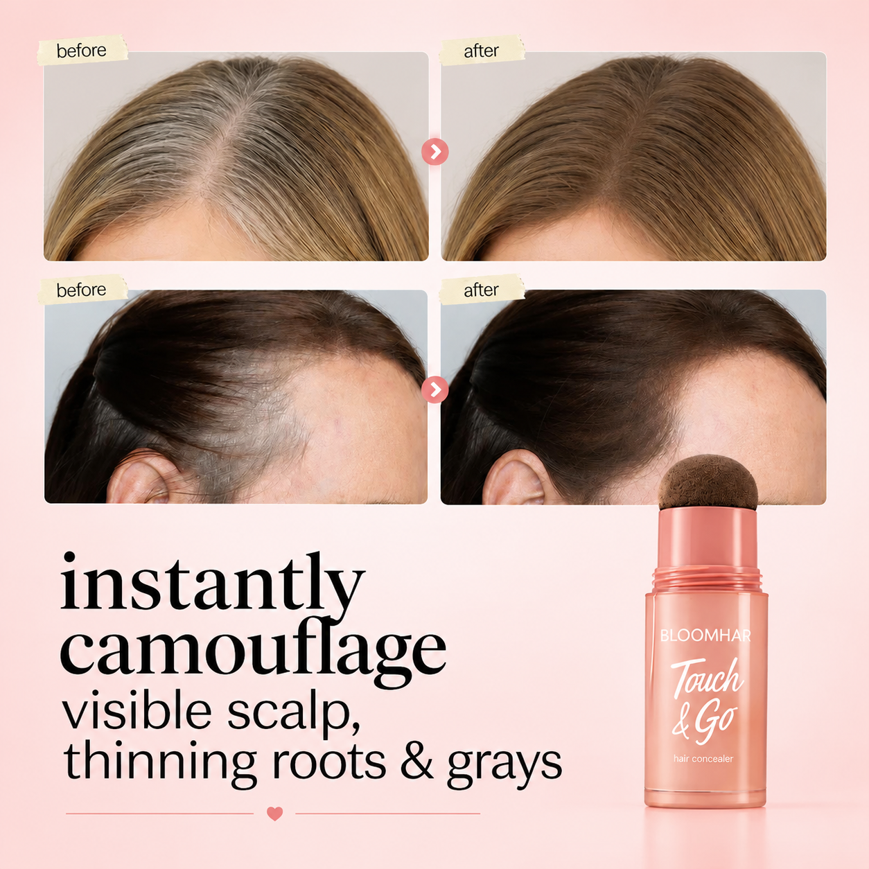 ⏰Last Day: Buy 1 Get 1 Free🎁 — Instantly Cover Roots, Grays & Sparse Hairlines