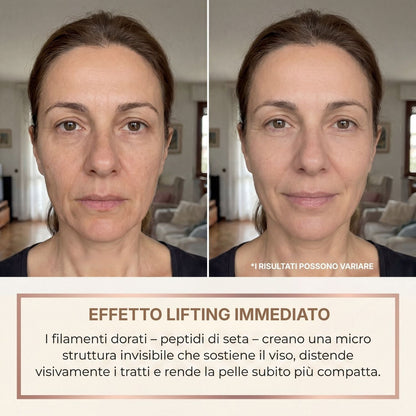Siero antirughe prima e dopo effetto lifting immediato rughe espressione