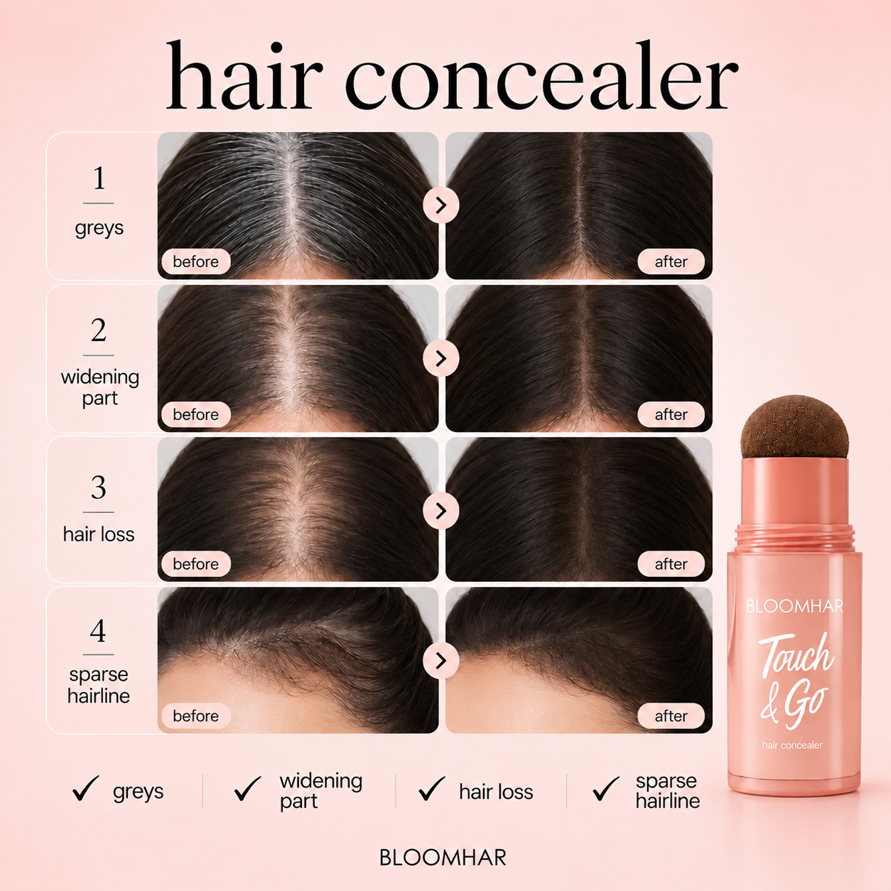 ⏰Last Day: Buy 1 Get 1 Free🎁 — Instantly Cover Roots, Grays & Sparse Hairlines