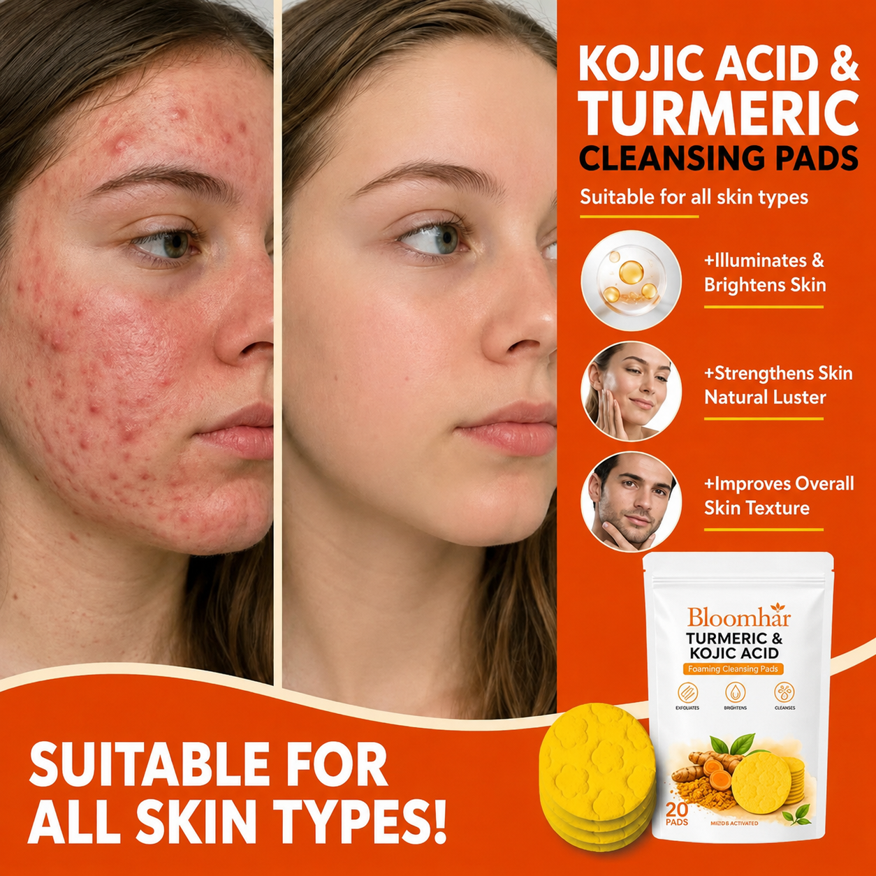 🔥Last Day 68% OFF-Bloomhar Turmeric Kojic Glow Pads