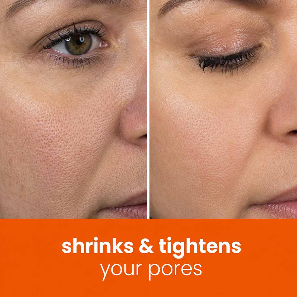 🔥Last Day 68% OFF-Bloomhar Turmeric Kojic Glow Pads